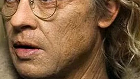 Boala rară care îl afectează pe Brad Pitt