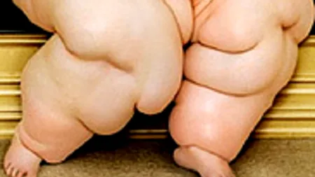 Pictorialul frumoaselor obeze: „E forma mea de protest