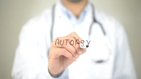 DETALII. Ce a relevat autopsia bărbatului împușcat mortal de polițiștii din Capitală