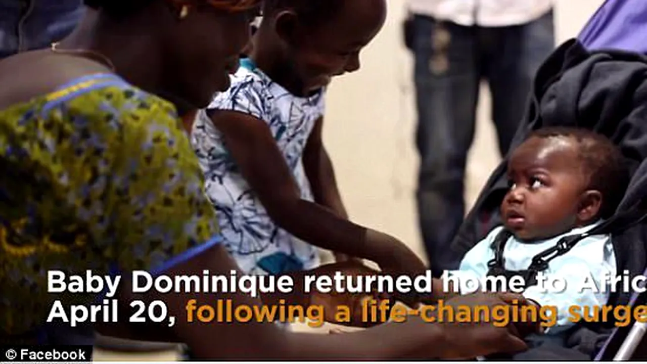 O fetiță de 11 luni a suferit o operație rară în SUA. Ce au descoperit medicii. VIDEO