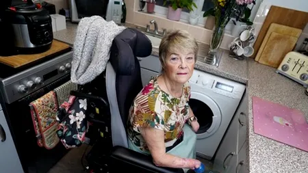 O femeie care așteaptă un TRANSPLANT pentru a avea din nou mâini a refuzat pentru a doua oară intervenția! Nu dorește membrele unui bărbat și nici ale unei femei de culoare