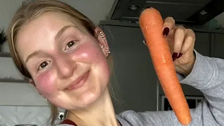 Cum a ajuns să arate această femeie VEGETARIANĂ, după ce a mâncat câte 10 morcovi în fiecare zi. Prietenele ei sunt îngrijorate!