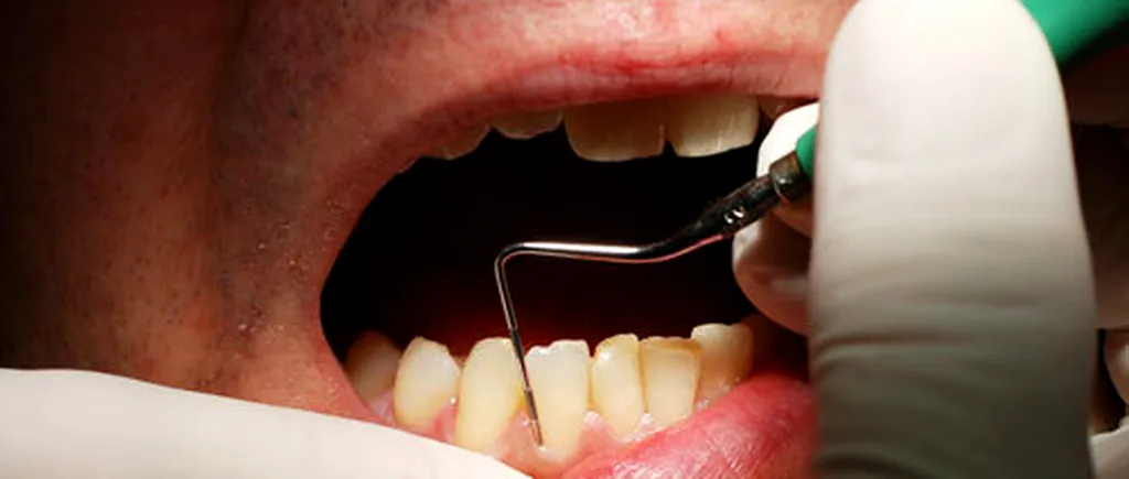 Cifre alarmante: Aproape 2 din 3 români au PROBLEME dentare / Aproape 80% preferă să ia medicamente în locul vizitei la stomatolog