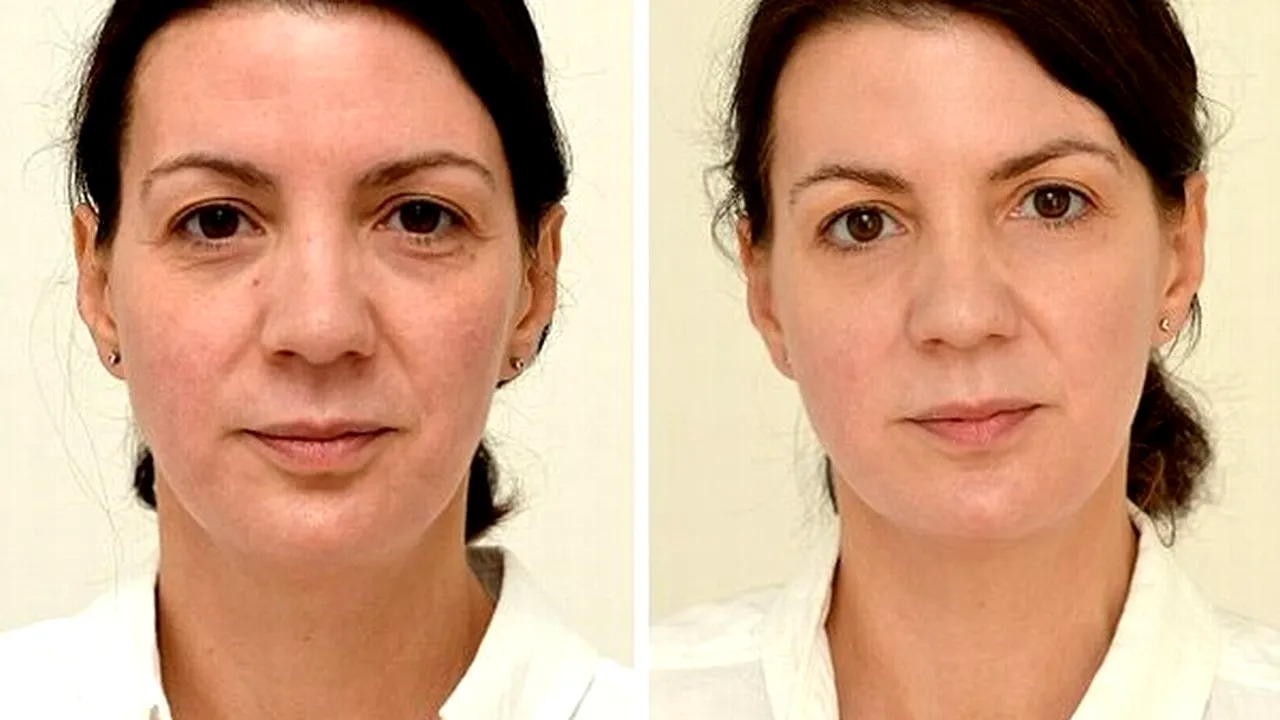 O femeie a ''întinerit'' cu zece ani după ce a băut trei litri de apă pe zi, timp de o lună