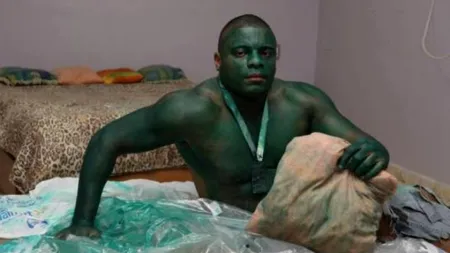 A intrat în pielea lui Hulk, dar nu a mai scăpat de culoare