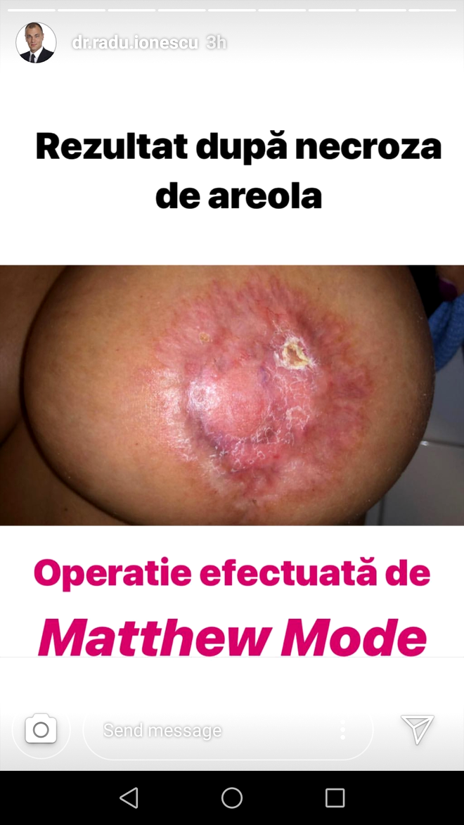 Imaginea unei femei mutilate după o operație a lui Matteo Politi