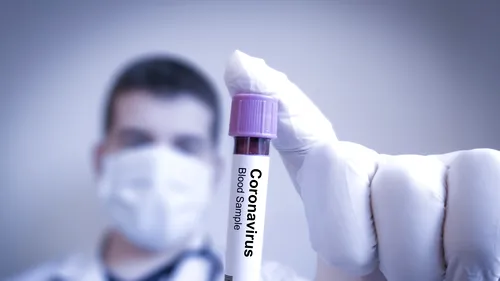 Bilanț coronavirus. România înregistrează un nou record de decese: 104!  Peste 4.700 de noi cazuri COVID-19, confirmate în ultimele 24