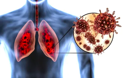 Persoanele nevaccinate domină bilanțul noilor cazuri confirmate cu COVID-19 și al deceselor. INSP: „Trebuie să protejăm persoanele vulnerabile!”