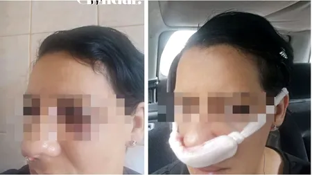 EXCLUSIV. Mărturia cutremurătoare a femeii mutilate de vecinul din bloc: „Îmi pune mesaje pe preș că țiganii trebuie să moară”