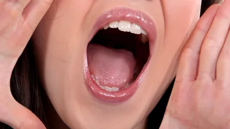 Cercetătorii elvețieni au descoperit Streptococus tigurinus, o bacterie periculoasă, care se găsește în cavitatea bucală