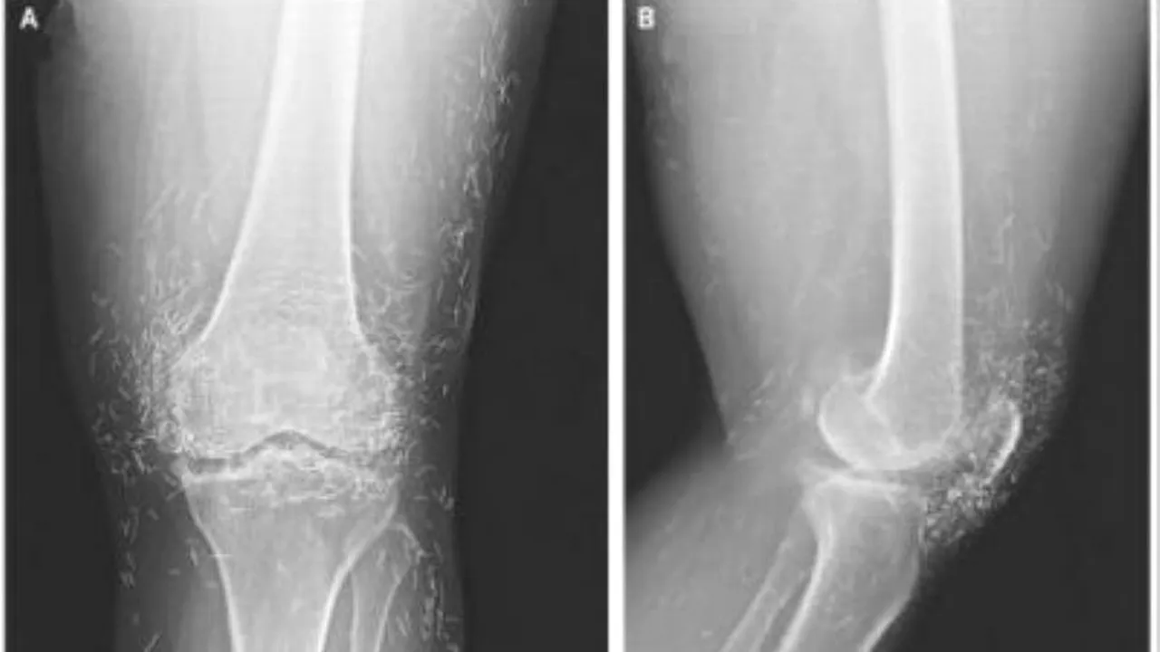 Descoperire facută după o radiografie: 