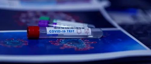 Țara care lansează o nouă metodă de testare a COVID-19. Ce presupune și cine sunt beneficiarii