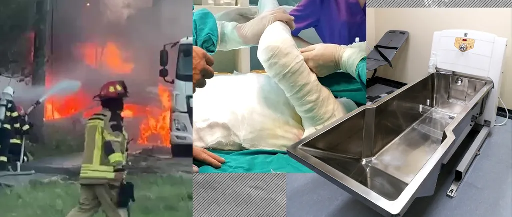 EXCLUSIV | Supraviețuitor din Colectiv: ”Un pacient cu arsură severă salvat în Germania costă 350.000 de euro. În România, se dau doar 90.000 de euro”
