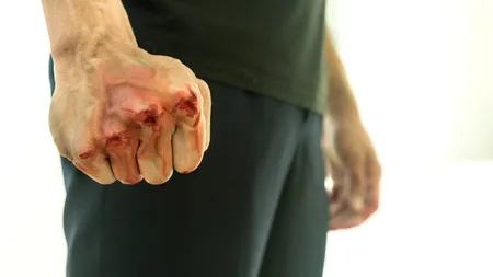 Agent de pază, bătut de doi tineri care nu voiau să poarte mască de protecție