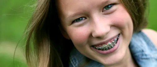 Cum convingem copiii să poarte de aparat dentar