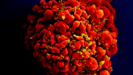 Alarmă în laboratoarele din SUA: ce boală a învățat să „păcălească” tratamentele cu un singur medicament