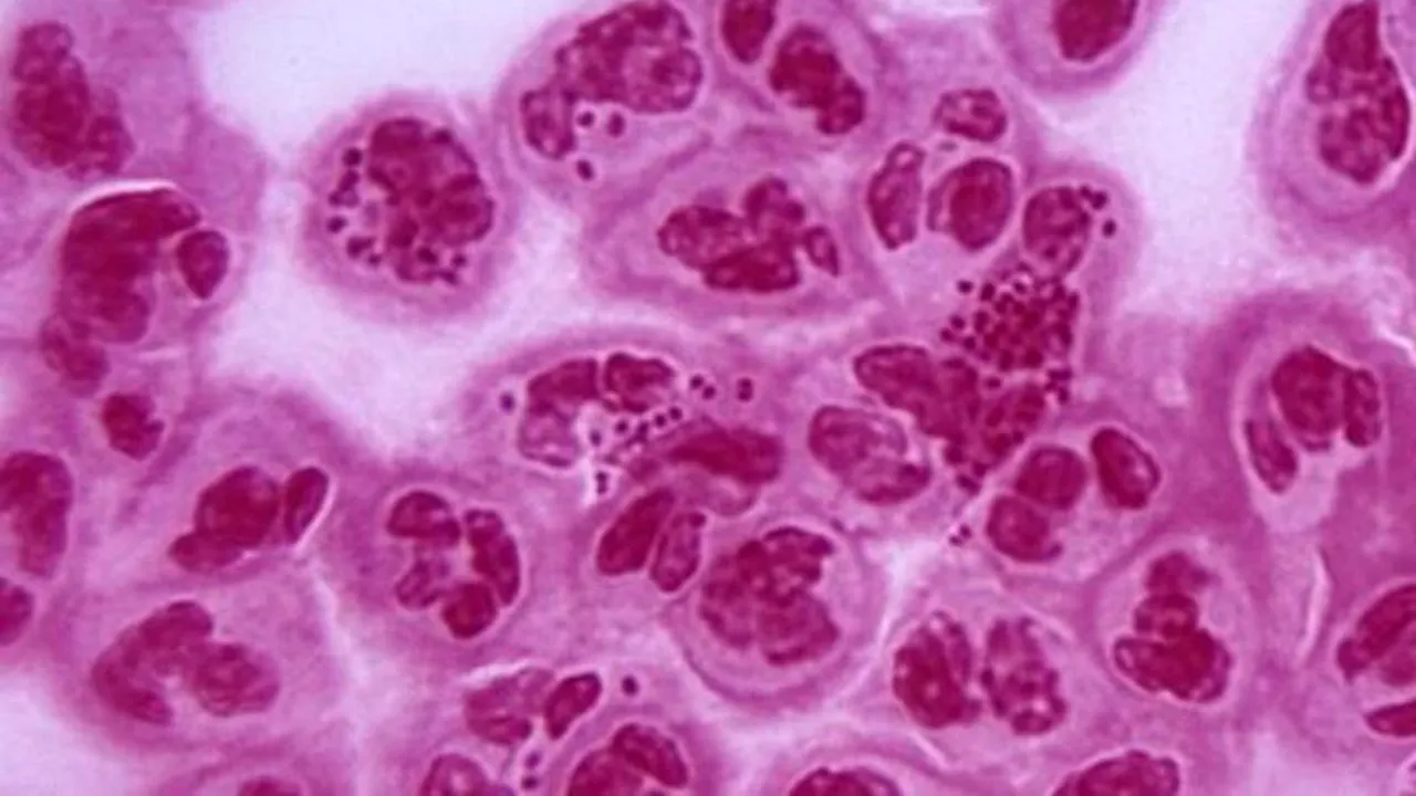 Americanii ar putea aloca 50 de milioane de dolari pentru găsirea unui tratament împotriva unei 