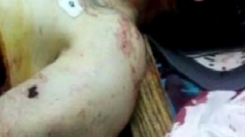 Detalii dure de la autopsia lui Tamerlan Tsarnaev. Atenție, imagini șocante!