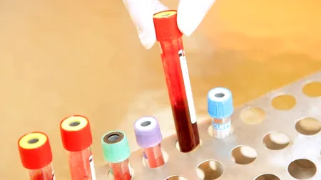 STUDIU. Peste cinci ani, cancerul ar putea deveni o boală tratabilă