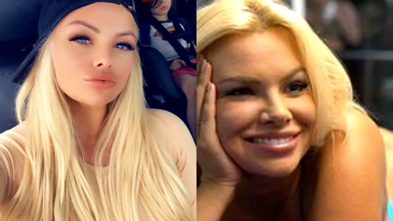 Petrecere bizară în Beverly Hills. Un fotomodel în bikini și-a operat fundul în fața a sute de invitați. „Nu a fost deloc dureros