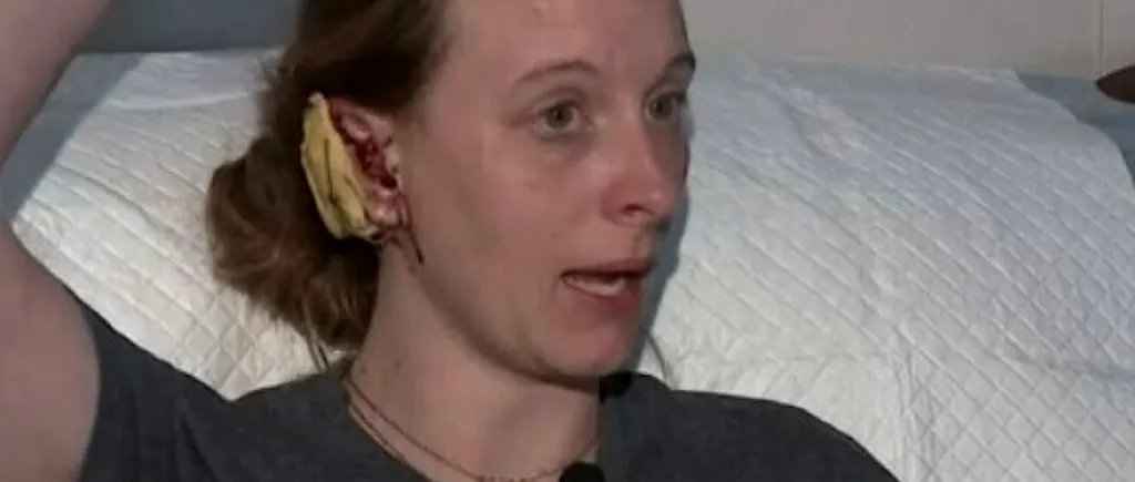 Femeie din SUA, MUTILATĂ de o maimuță! I-a rupt o ureche și a lăsat-o fără păr