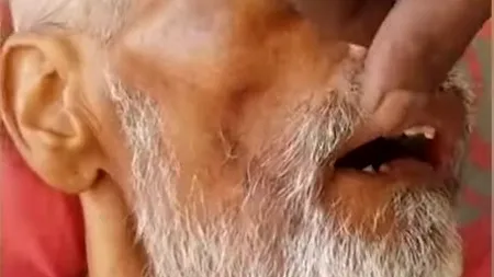 Neglijență dusă la extrem: M-au asigurat că vor avea grijă de el, inclusiv de igienă, dar îi mișunau prin gură. Ce a descoperit bărbatul când și-a vizitat tatăl la spital - VIDEO