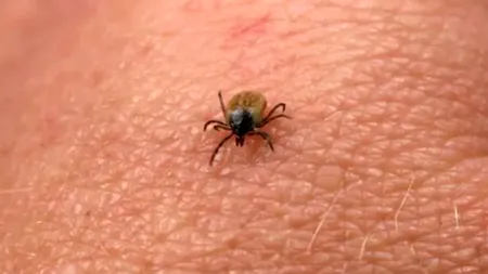 Cum scapi de CĂPUȘE dacă stai la curte. Acest truc va ține la distanță insectele