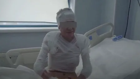 Mărturia cutremurătoare a tinerei incendiate de criminalul din Mehedinți: „Vă rog să mă ajutați să devin din nou un om normal” (VIDEO)