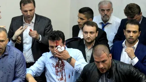 Important lider politic din Macedonia, rănit în urma unei bătăi în Parlament
