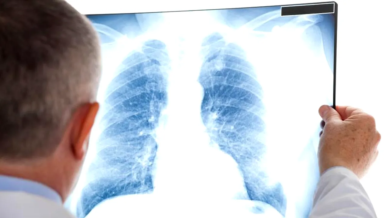 Medic, despre criza sanitară din Cluj : Nu sunt nicăieri paturi de terapie intensivă