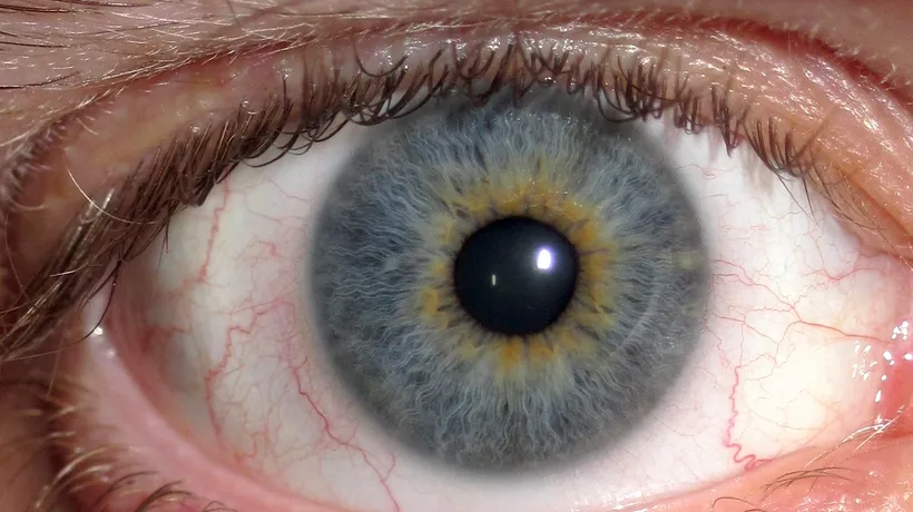Cum sunt afectați ochii de privitul la calculator 
