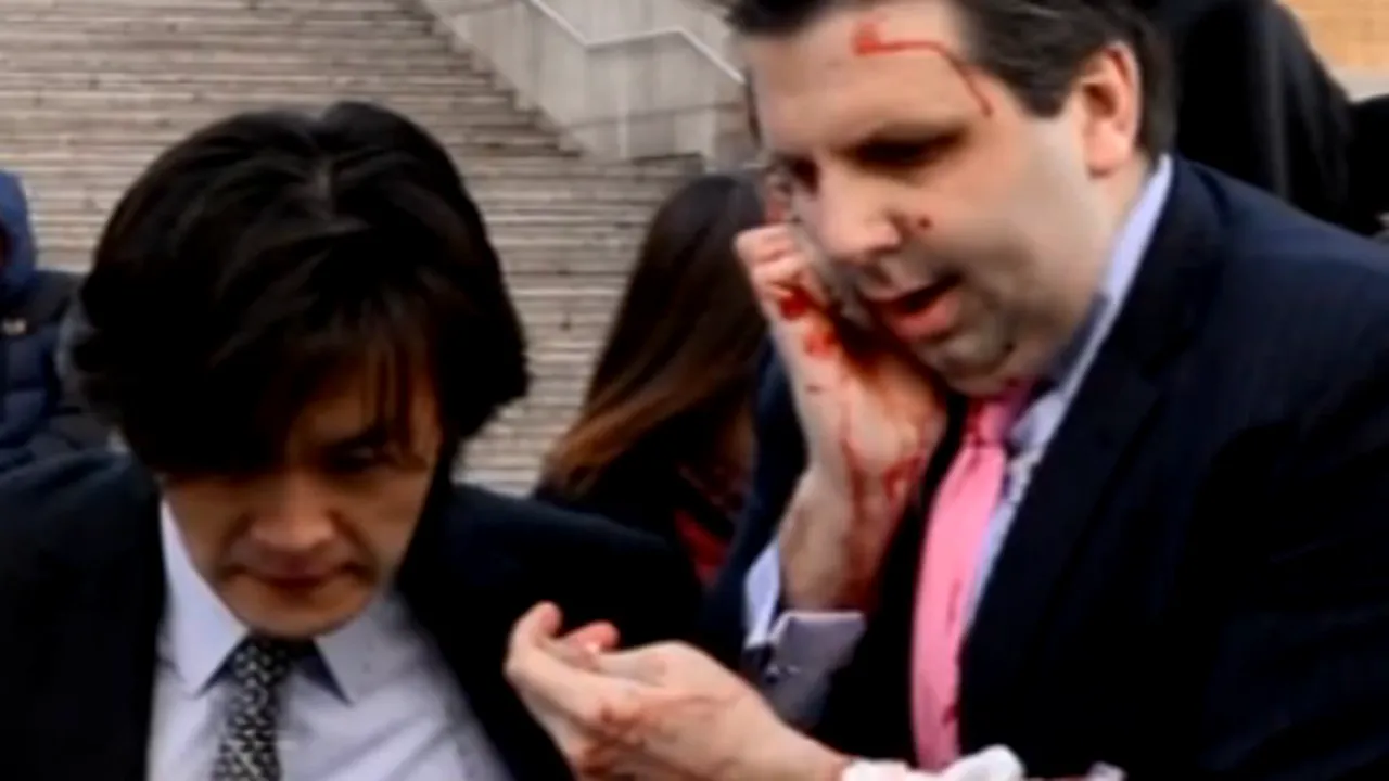 Care este starea ambasadorului SUA în Coreea de Sud după ce a fost tăiat pe față
