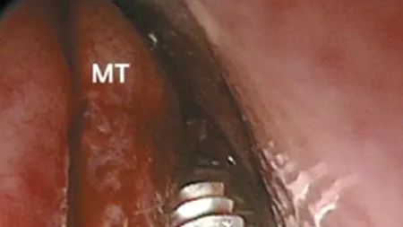 Avea dureri insuportabile după o vizită la stomatolog: ce au descoperit medicii la radiografie