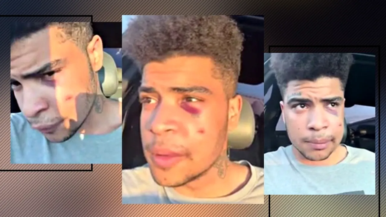 VIDEO | Un rapp-er acuză un polițist din Cluj că l-a bătut: „M-a umflat fără motiv” / IPJ transmite că a devenit agresiv cu agenții, după ce a fost informat că nu mai are voie să se apropie de fosta iubită