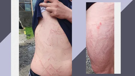 Un turist a fost lovit de FULGER, în Munții Făgăraș, și a supraviețuit. După ce a fost inconștient 30 de minute, bărbatul a coborât singur de pe munte