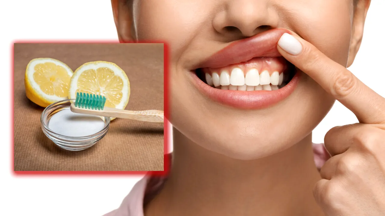 Îți albești dinții cu bicarbonat de sodiu sau lămâie? Un medic stomatolog avertizează: „Nu se mai regenerează”