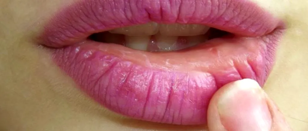 Sângerările inexplicabile la nivelul cavității bucale pot anunța prezența unei boli grave. Semnele care trebuie să te trimită la medic 
