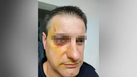 Polițist atacat de un refugiat într-un centru de cazare pentru imigranți. Ofițerul a avut nevoie de intervenția medicilor