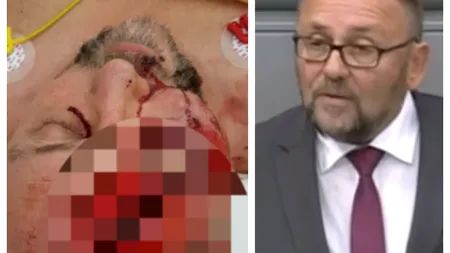 Politician de extremă-dreapta BĂTUT din motive politice. Frank Magnitz (AfD) e în stare GRAVĂ la spital