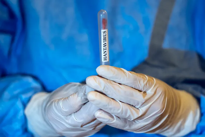 Caz suspect de hantavirus depistat în Spania. Anunțul secretarului de stat pentru sănătate