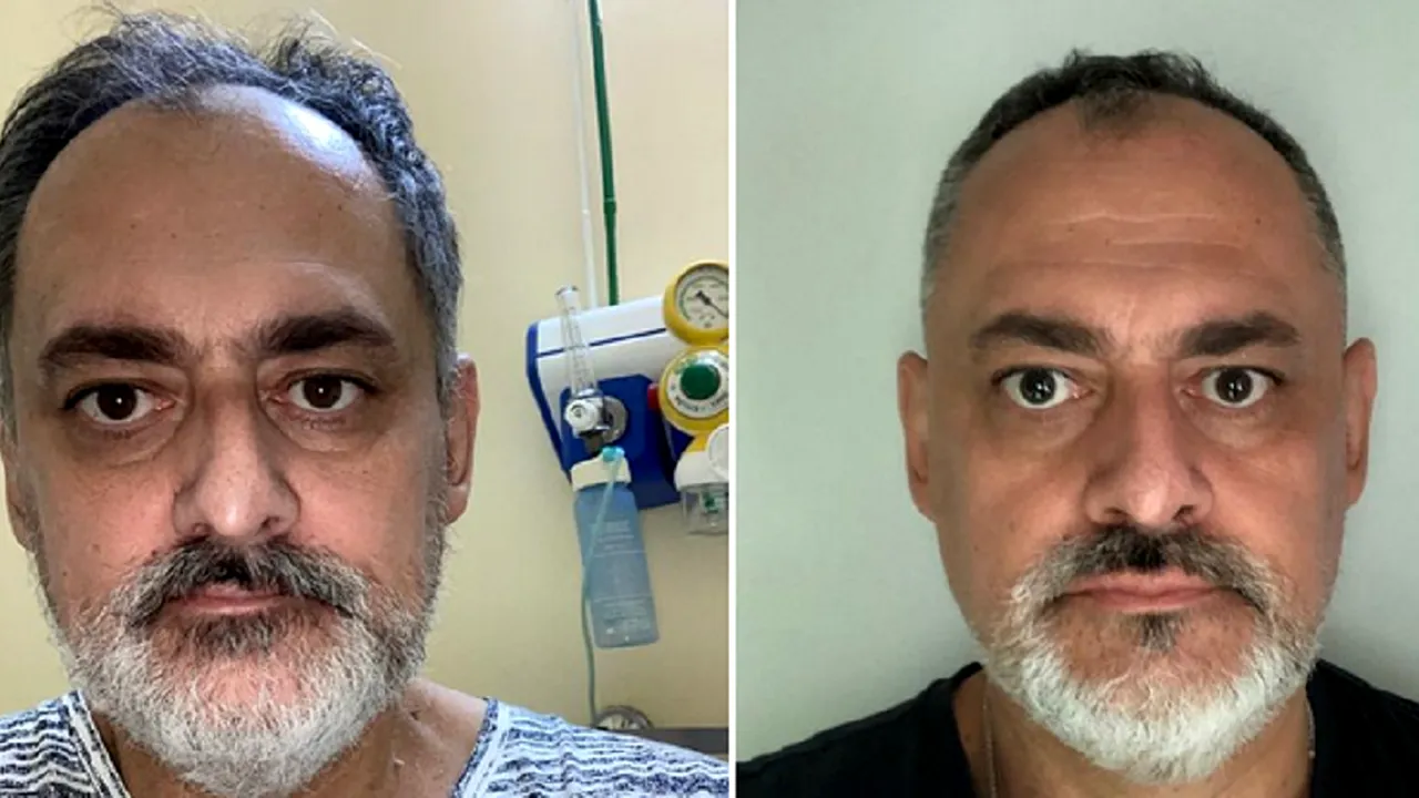 Povestea unui român bolnav de Covid, care a fost internat un an în spital. Bărbatul a rămas cu sechele pentru tot restul vieții: „Nu este o simplă răceală, nu este un complot mondial”