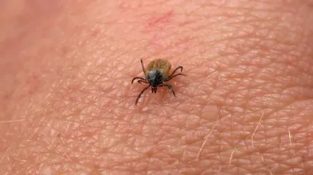 Medicul Virgil Musta, despre riscurile de infectare cu boala Lyme în cazul unei mușcături de căpușă: Organismul are mecanisme de a o limita