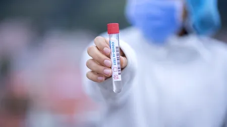 Testul rapid pentru COVID-19 care dă rezultatul în 15 minute a ajuns și în România! Cu ce este diferit față de un PCR (EXCLUSIV)