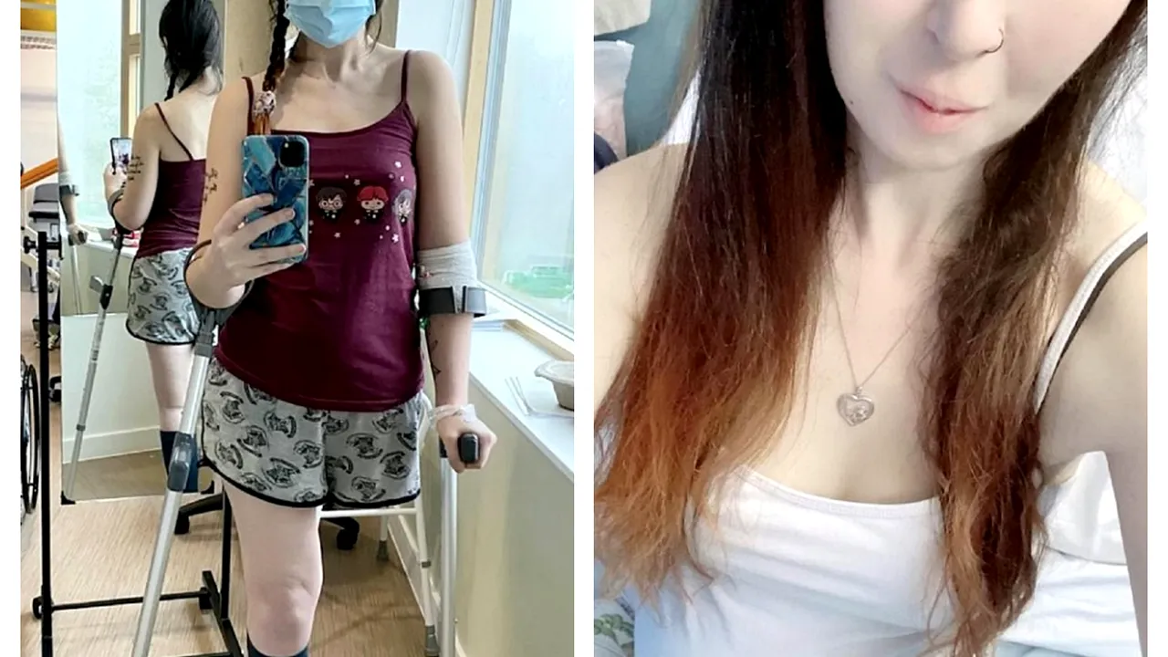 Gestul emoționant pe care l-a facut o mamă bolnavă de cancer. Și-a amputat piciorul pentru a salva viaţa copilului nenăscut