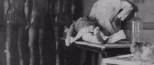 După 30 de ani în care au stat într-o pungă, rămășițele lui Mengele au fost examinate. Ce au descoperit cercetătorii