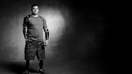 Și-a pierdut mâinile și picioarele în războiul din Afganistan, dar a devenit o sursă de inspirație pentru o lume întreagă: „Nu credeam că voi trăi