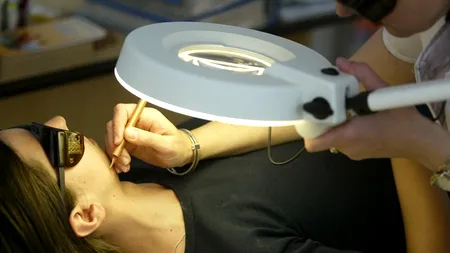 Consultații gratuite pentru persoanele cu acnee. Lista clinicilor din București