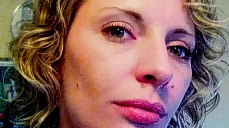 Era o tânără atrăgătoare, dar a fost desfigurată de o boală rară. Cazul său a ajuns subiect de documentar