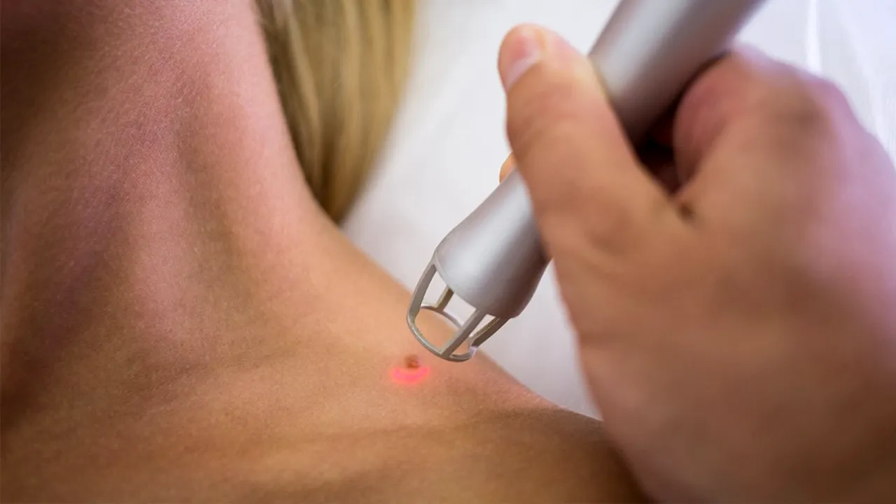 Care sunt afecțiunile pe care le poți evalua mergând la un cabinet de dermatologie din Suceava (P)