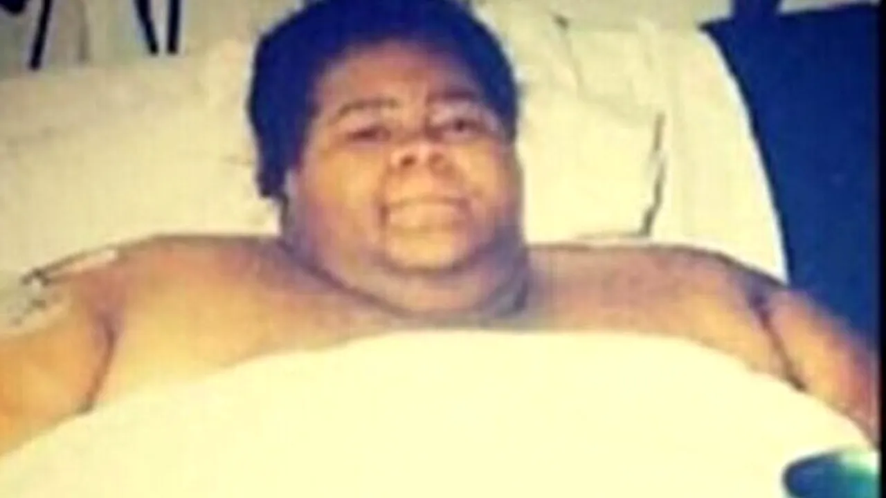 Femeia din imagine avea peste 450 de kilograme, în 2005. Cum A AJUNS să arate după 18 ani